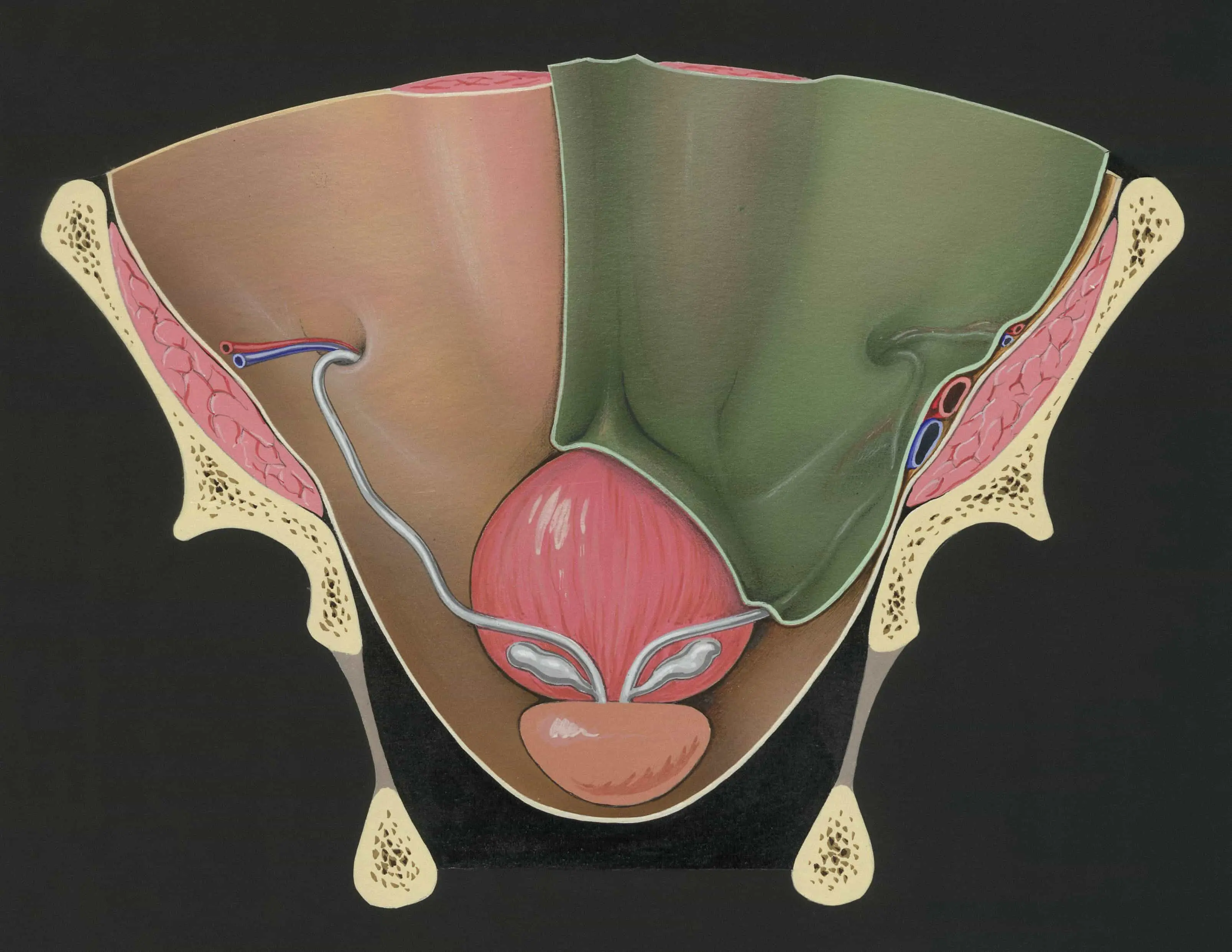 Thumbnail for Is Iron The Problem? Hidden Cells Fuelling Prostate Cancer