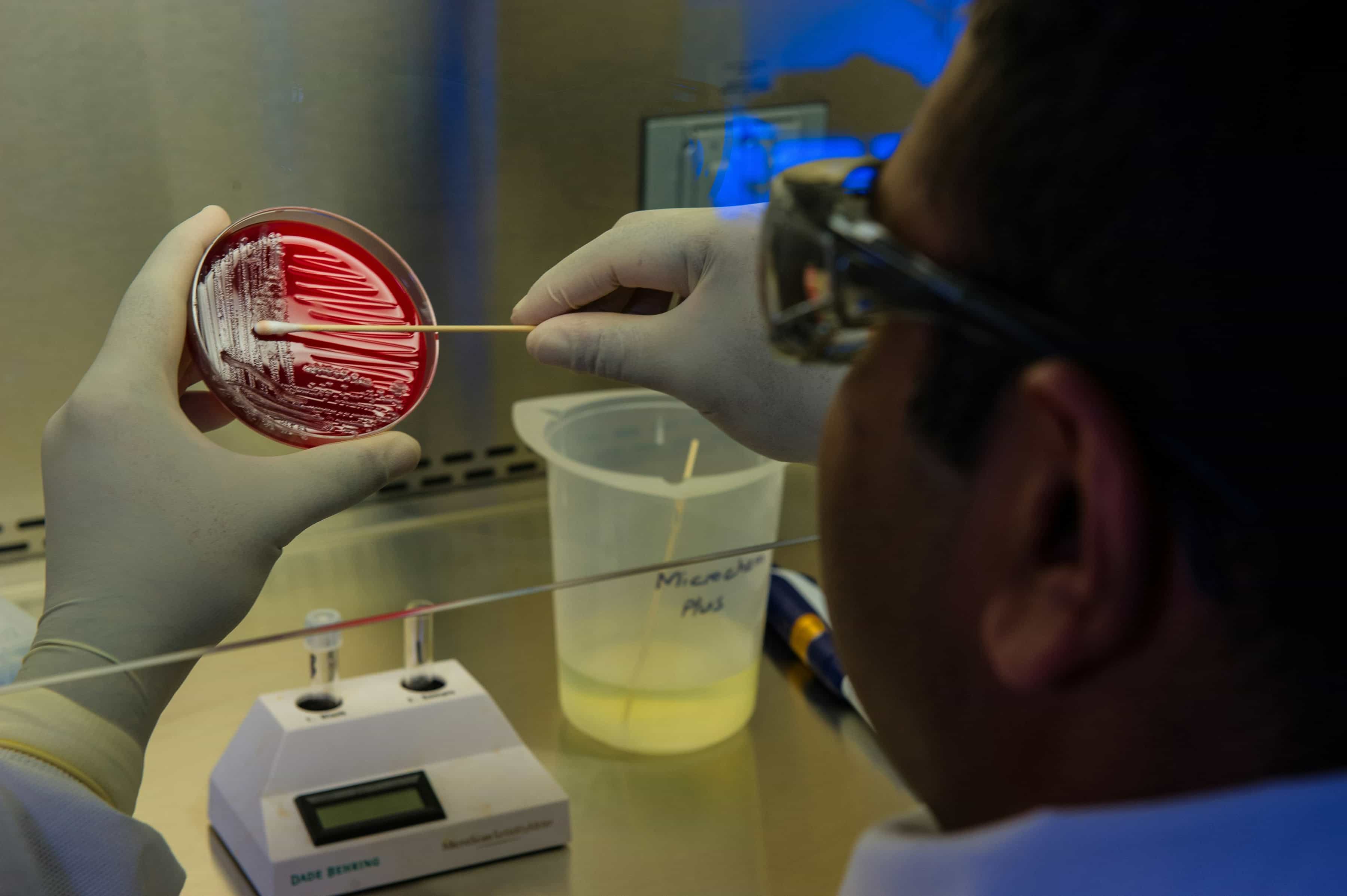 Featured image for Personalized Antibiotic Testing: A Smarter Way to Fight Superbugs