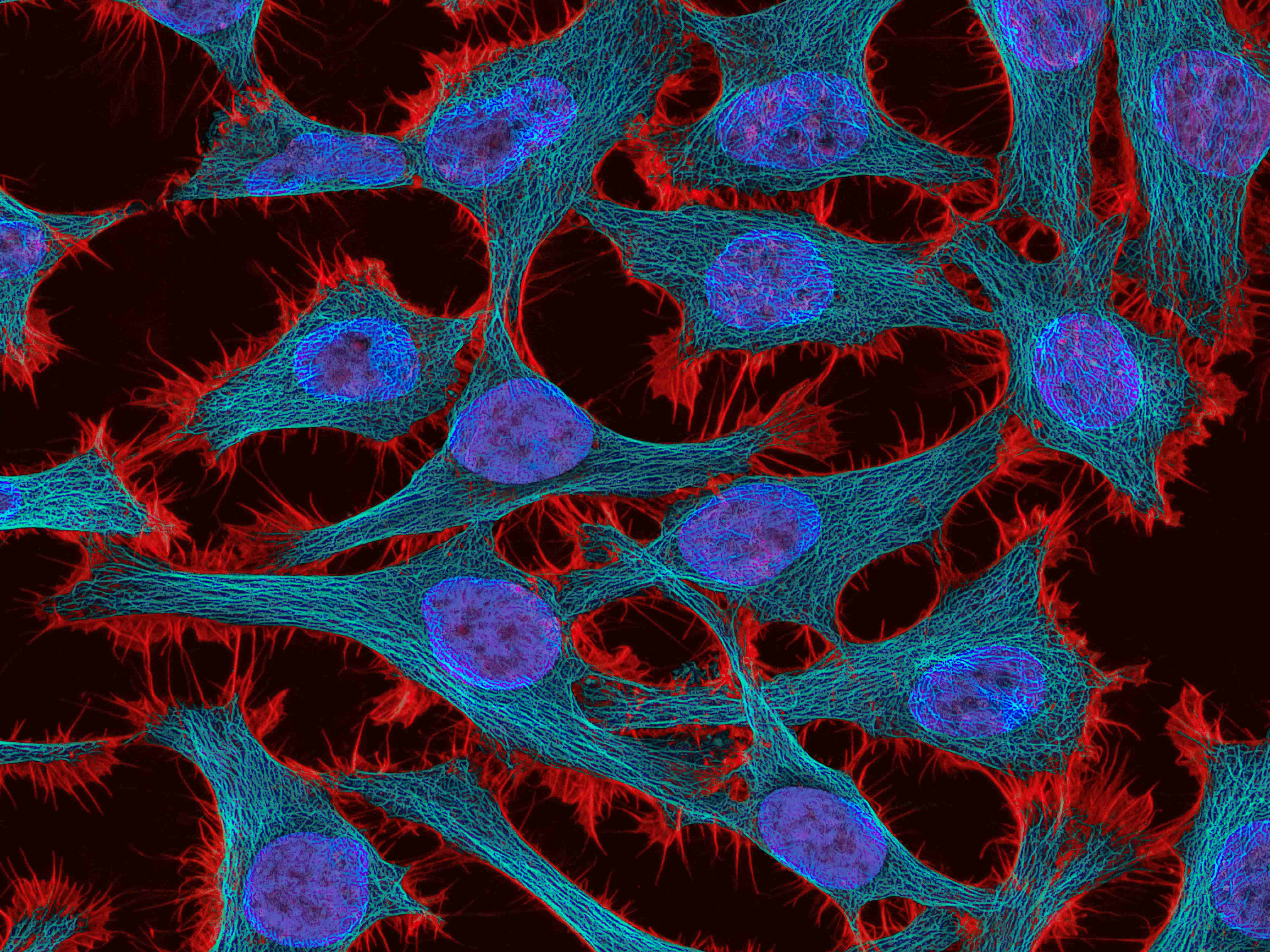 Featured image for New Insights into Cervical Cancer Could Revolutionize Treatment